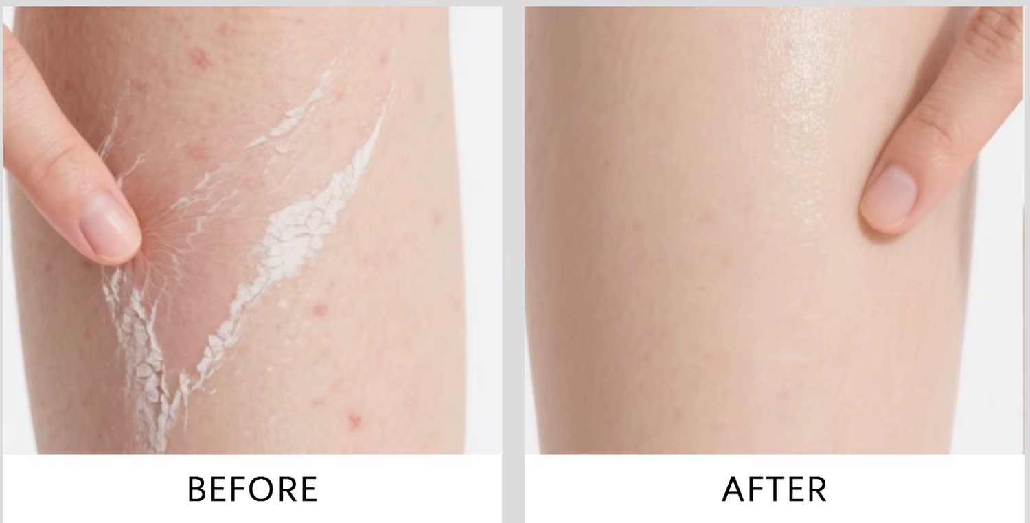 Body skin before and after using the SUNMERE exfoliating spray